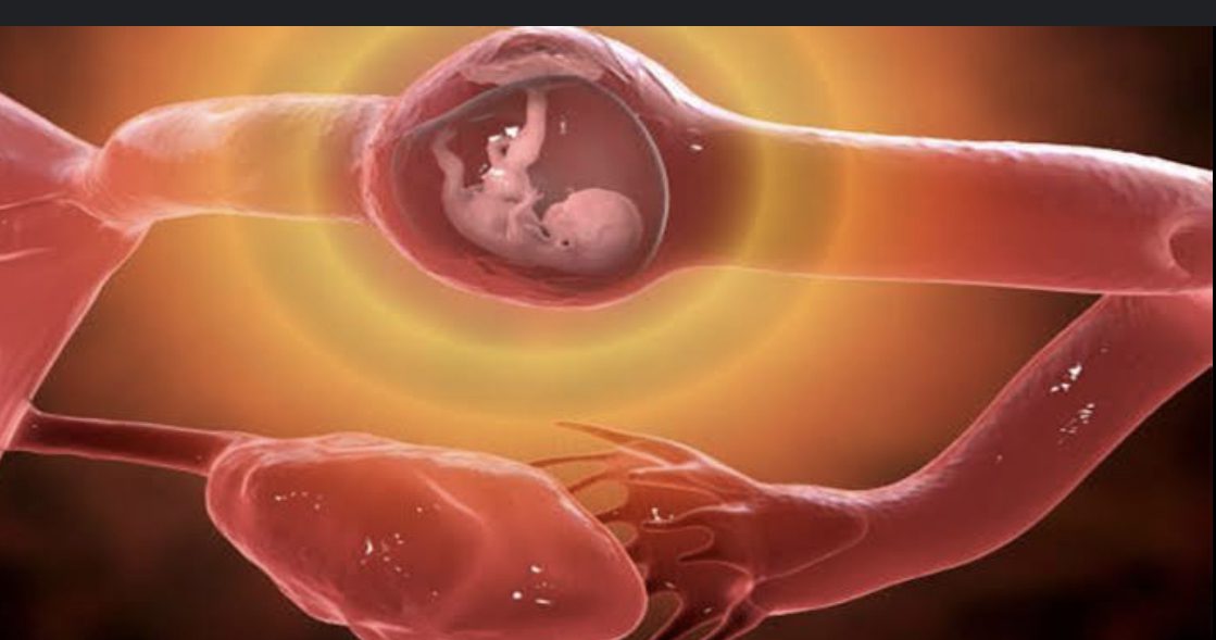 BDDB8938-72AE-4815-88A0-4246FF16BEB1